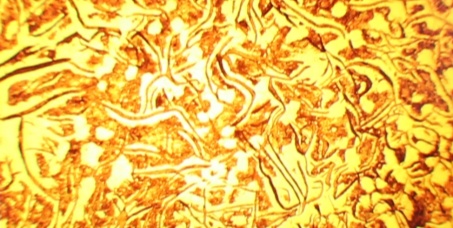 5 Schlüssel zur Verlängerung der Lebensdauer von Verschleißteilen beim Lost Foam Casting